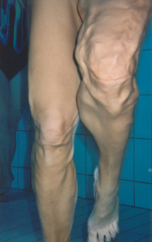 Aquajogging, Aquatraining, Aquatherapie bei Margot Zeitvogel-Schönthier, Massagewirkung beim Joggen im Wasser Aquajogging, Aquatraining, Aquatherapie bei Margot Zeitvogel-Schönthier, Massagewirkung beim Joggen im Wasser